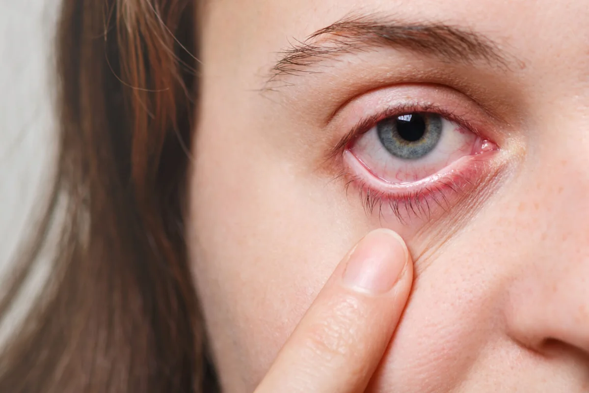 Cornea & External Diseases image